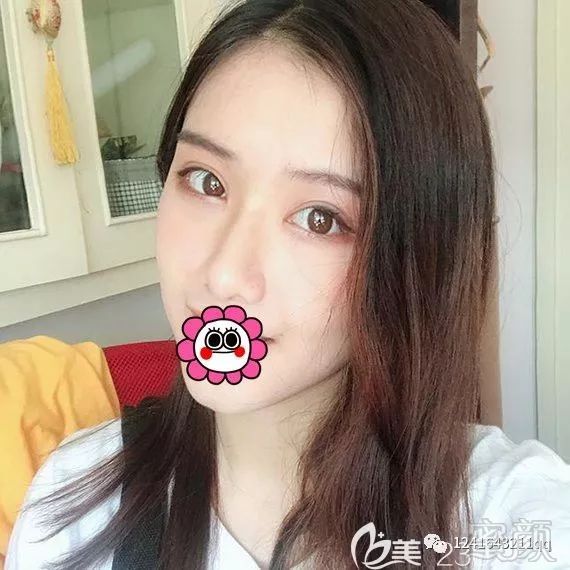 https://img.miyanlife.com/mnt/timg/190823/13060350W-3.jpg