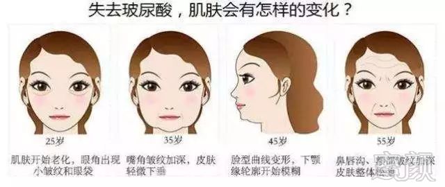 https://img.miyanlife.com/mnt/timg/190823/1313316319-3.jpg
