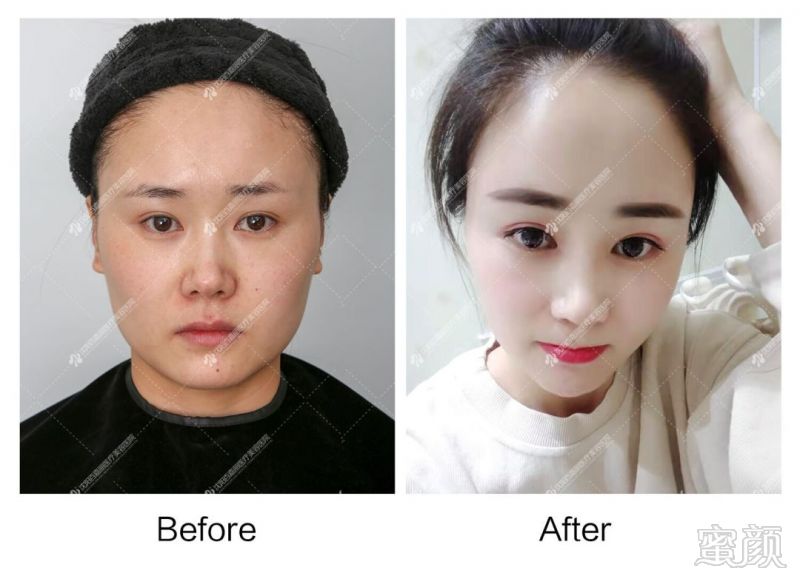 https://img.miyanlife.com/mnt/timg/190823/13133B2W-10.jpg