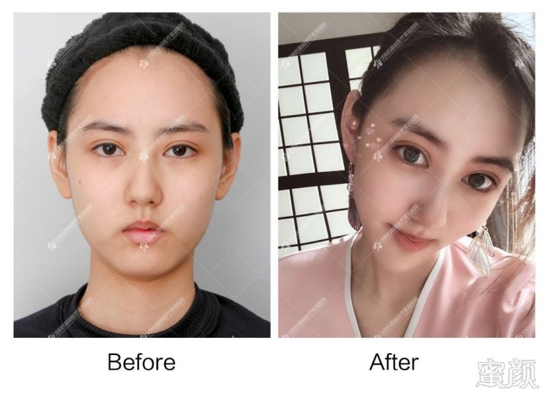 https://img.miyanlife.com/mnt/timg/190823/13133KA6-11.jpg