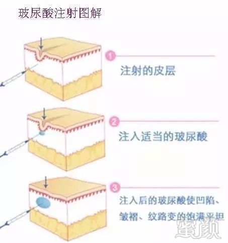 https://img.miyanlife.com/mnt/timg/190823/1314342G5-2.jpg