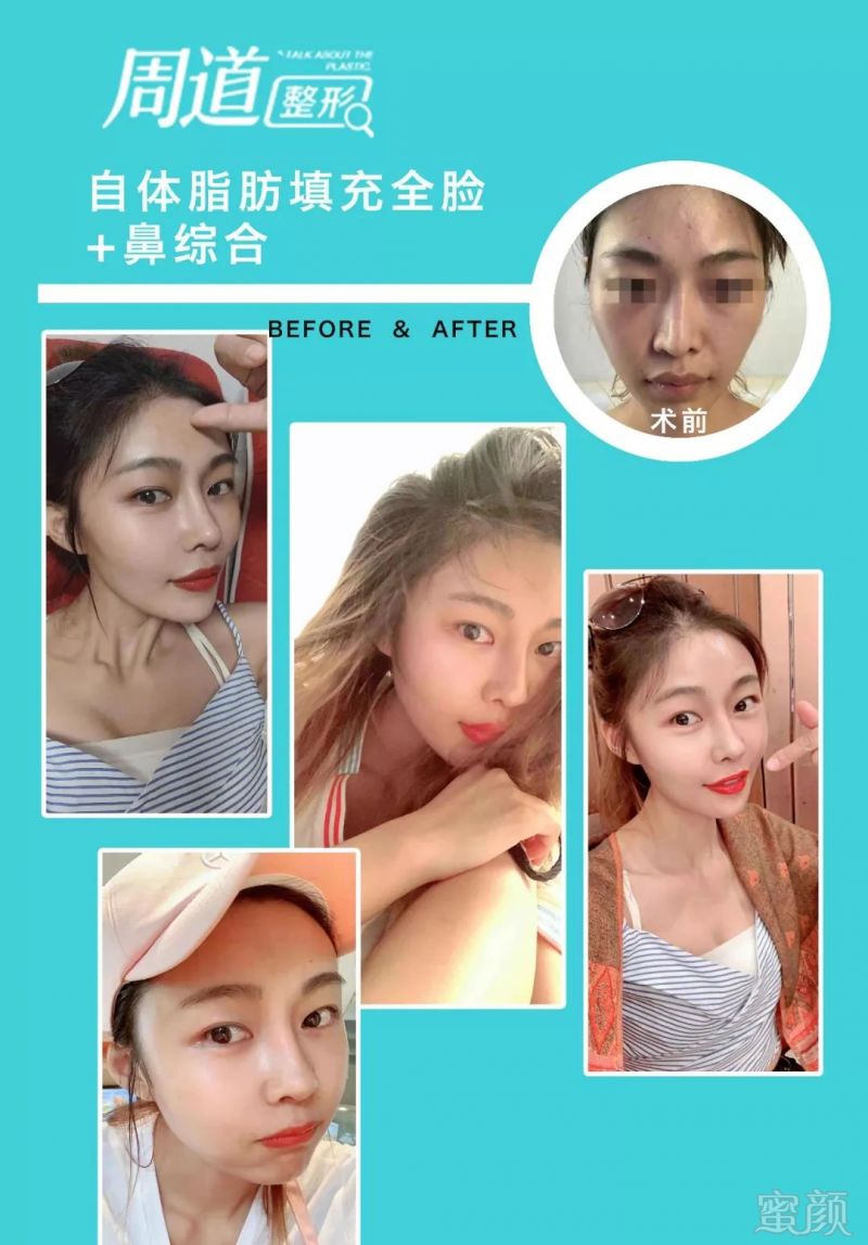 https://img.miyanlife.com/mnt/timg/190823/1314364619-6.jpg