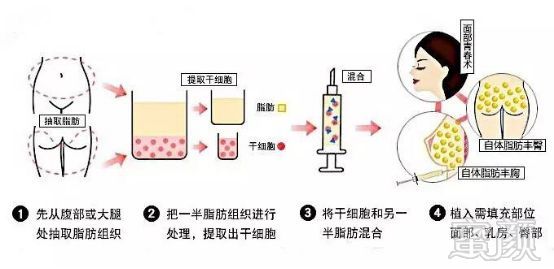 https://img.miyanlife.com/mnt/timg/190823/13143Q006-7.jpg