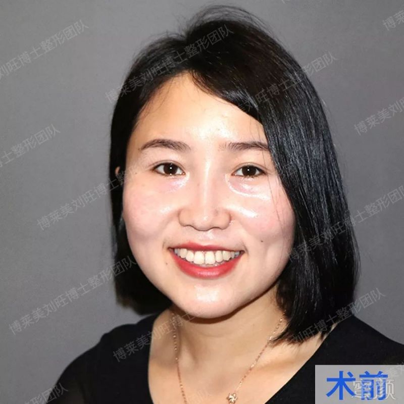 https://img.miyanlife.com/mnt/timg/190823/1322196052-0.jpg