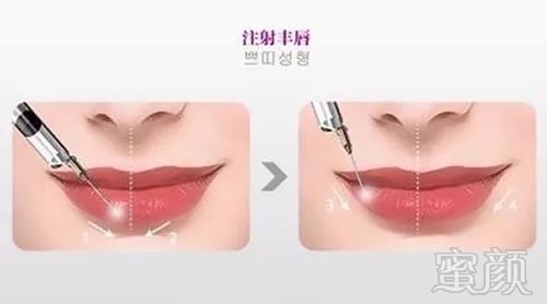 https://img.miyanlife.com/mnt/timg/190824/1405125959-2.jpg