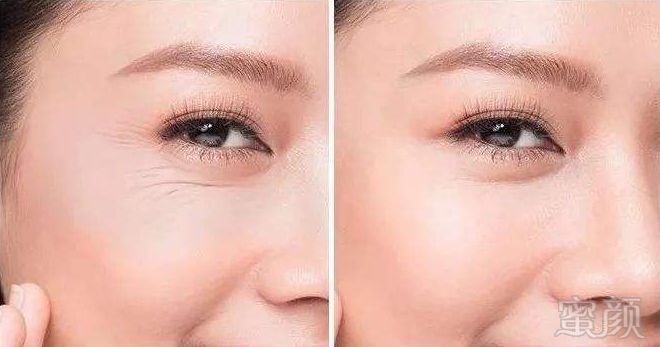 https://img.miyanlife.com/mnt/timg/190824/140S92G2-9.jpg