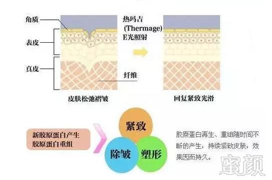 https://img.miyanlife.com/mnt/timg/190824/140SJ331-6.jpg