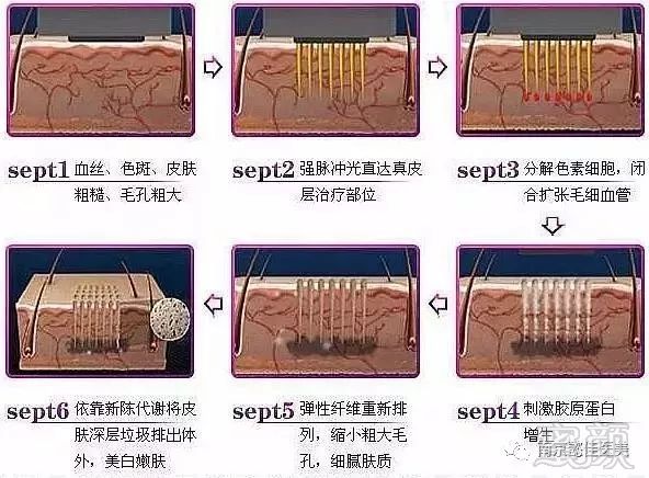 案例图片