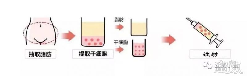 https://img.miyanlife.com/mnt/timg/190825/1050213217-0.jpg
