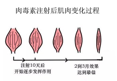 https://img.miyanlife.com/mnt/timg/190825/1055013226-3.jpg