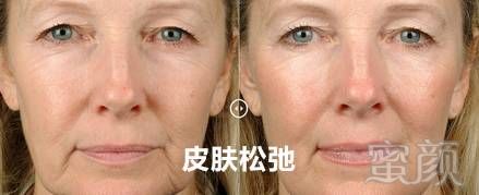 https://img.miyanlife.com/mnt/timg/190825/1056302152-8.jpg