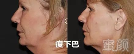 https://img.miyanlife.com/mnt/timg/190825/1056315131-9.jpg