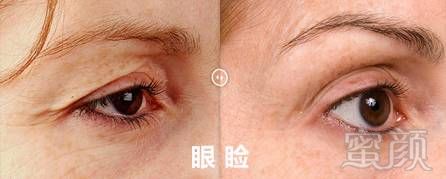 https://img.miyanlife.com/mnt/timg/190825/1056334247-11.jpg