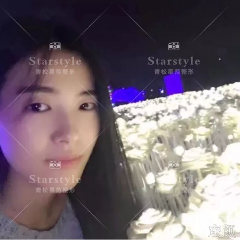 https://img.miyanlife.com/mnt/timg/190826/1530492261-5.jpg