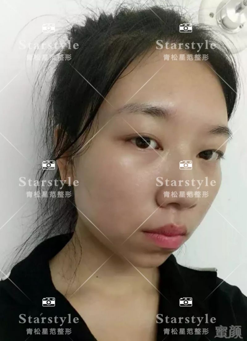 https://img.miyanlife.com/mnt/timg/190826/1531001037-13.jpg