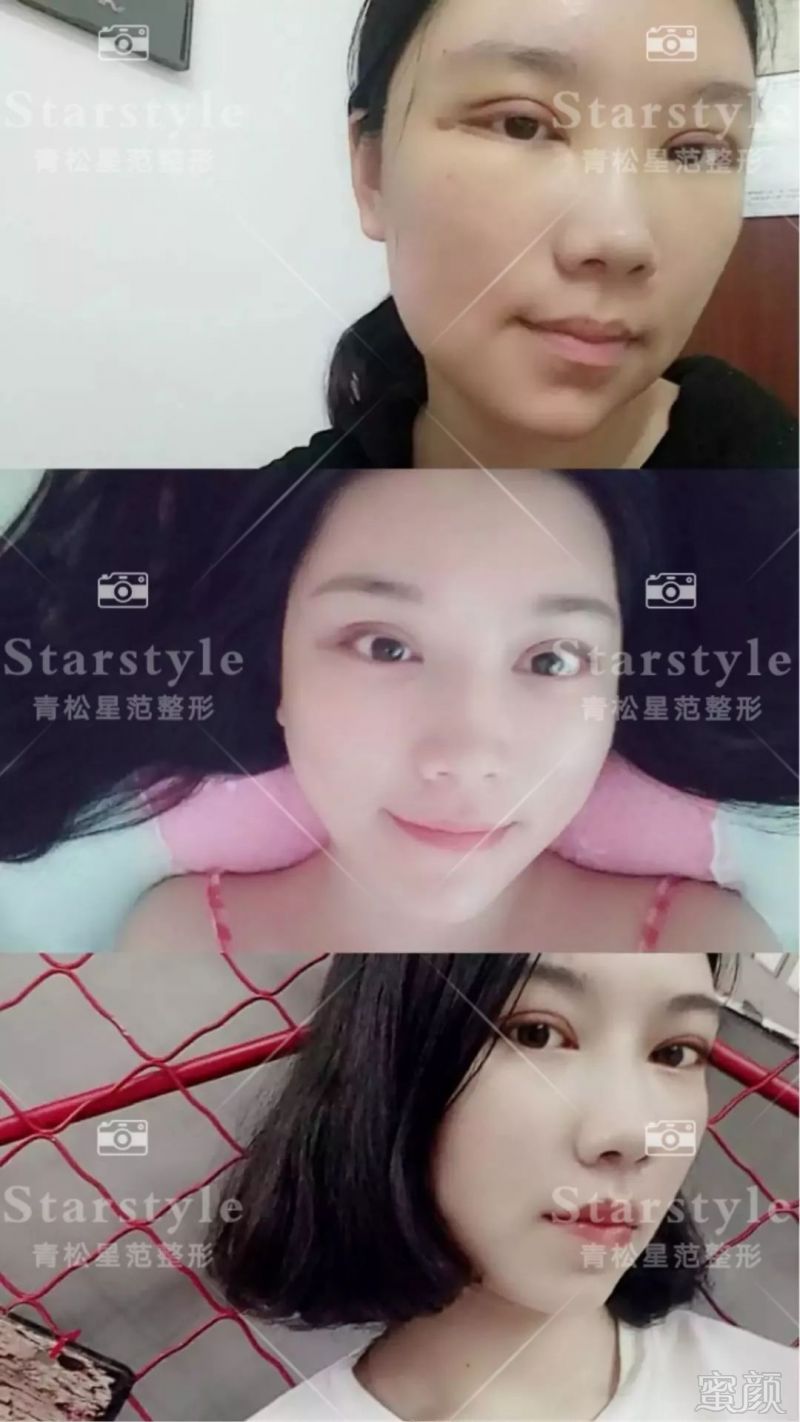 https://img.miyanlife.com/mnt/timg/190826/1531011B4-14.jpg
