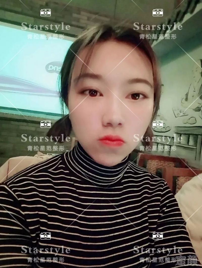 https://img.miyanlife.com/mnt/timg/190826/1531034410-15.jpg