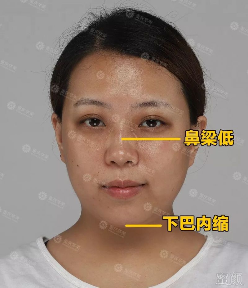 https://img.miyanlife.com/mnt/timg/190826/1539361Z1-6.jpg