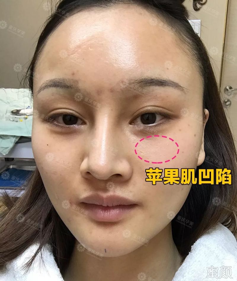 https://img.miyanlife.com/mnt/timg/190826/15393a204-8.jpg