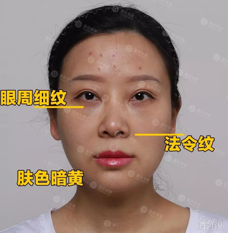 https://img.miyanlife.com/mnt/timg/190826/1539435D6-11.jpg