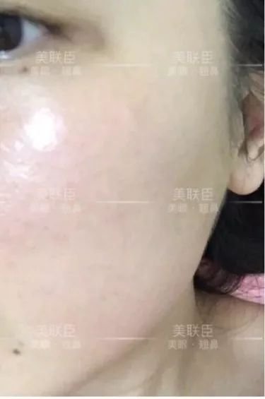https://img.miyanlife.com/mnt/timg/190826/154530DO-5.jpg