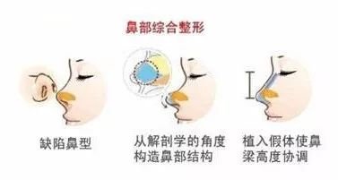 https://img.miyanlife.com/mnt/timg/190826/155K322K-4.jpg