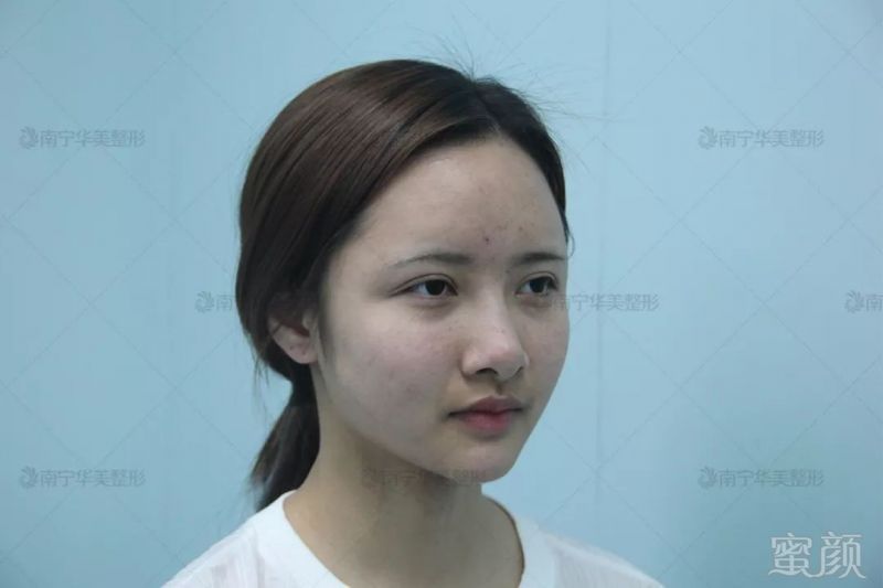 https://img.miyanlife.com/mnt/timg/190826/1606333X2-5.jpg