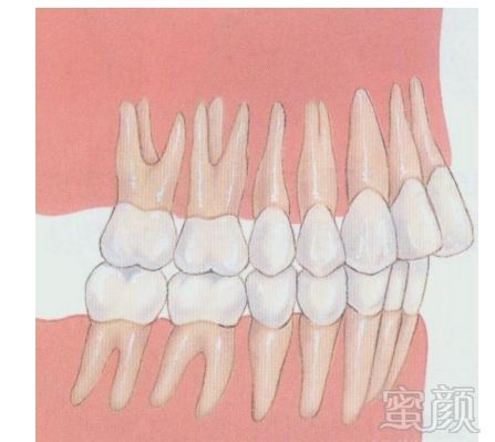 案例图片