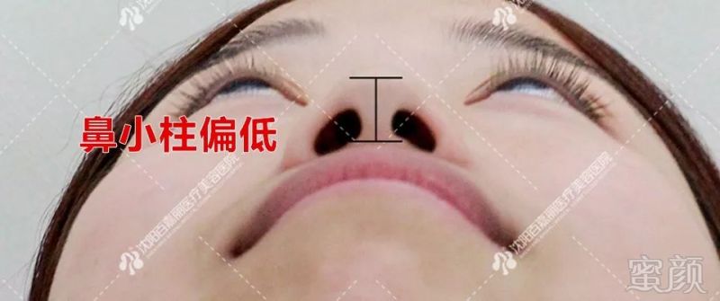 https://img.miyanlife.com/mnt/timg/190827/14235MO1-6.jpg