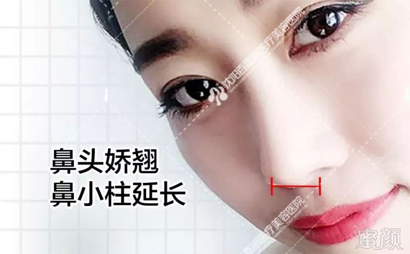 https://img.miyanlife.com/mnt/timg/190827/14235T413-7.jpg