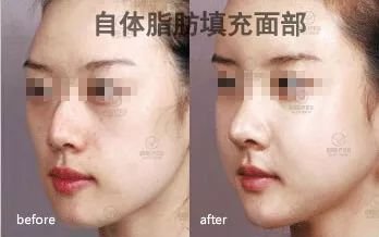 https://img.miyanlife.com/mnt/timg/190828/1502212G8-5.jpg