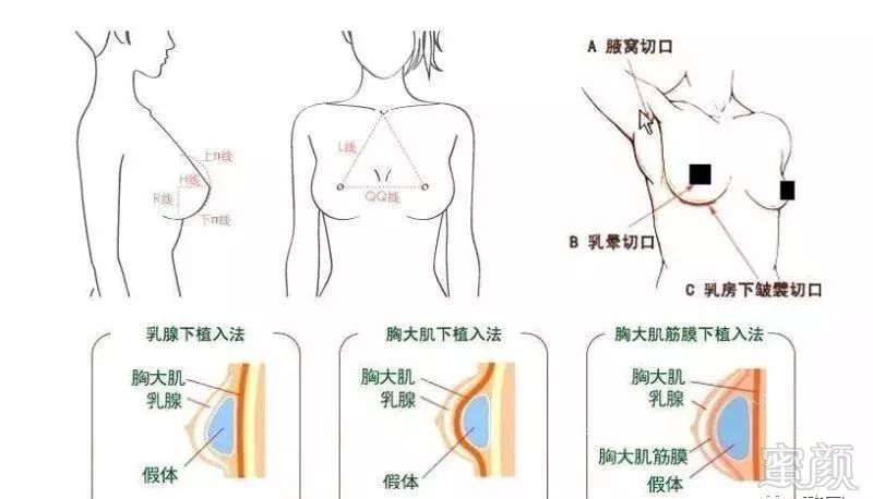 案例图片