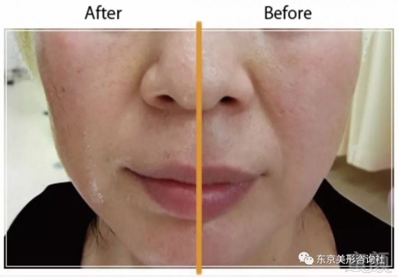 https://img.miyanlife.com/mnt/timg/190829/12314M446-7.jpg