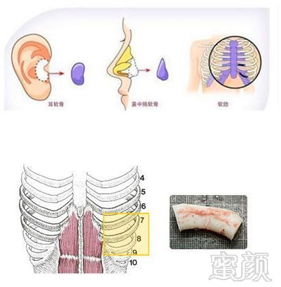 案例图片