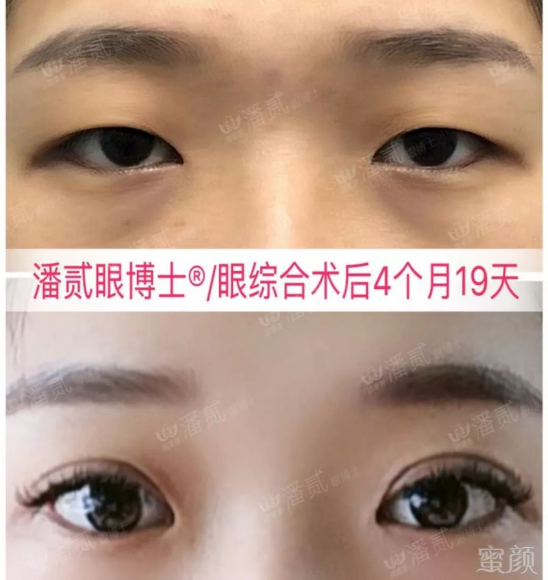 https://img.miyanlife.com/mnt/timg/190829/13450TN7-3.jpg