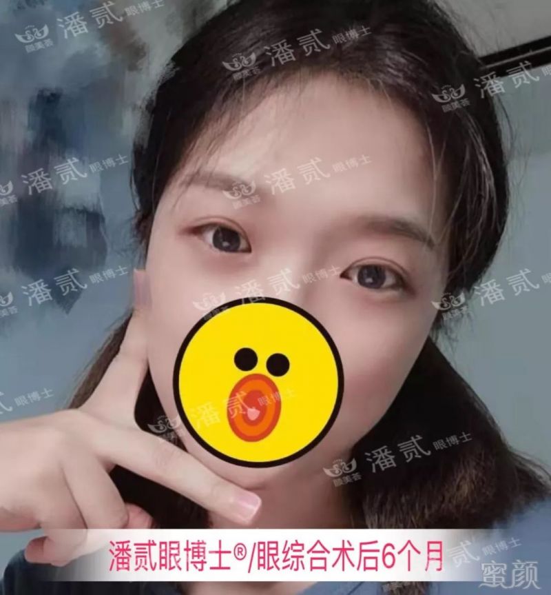 https://img.miyanlife.com/mnt/timg/190829/1345113595-4.jpg