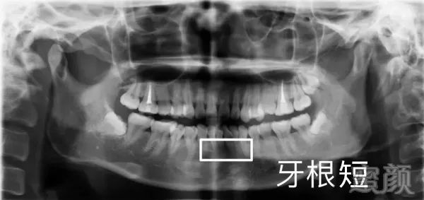 案例图片