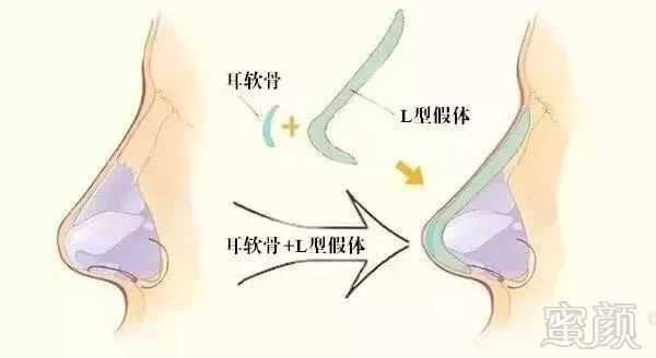 https://img.miyanlife.com/mnt/timg/190829/1524412924-0.jpg
