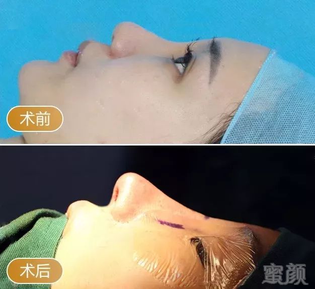 https://img.miyanlife.com/mnt/timg/190829/15261H134-7.jpg