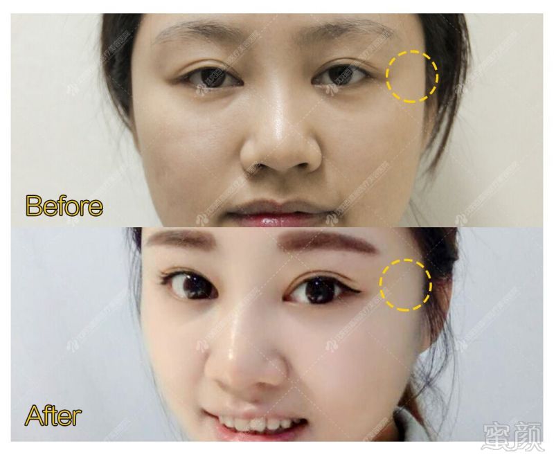 https://img.miyanlife.com/mnt/timg/190830/130529C39-3.jpg