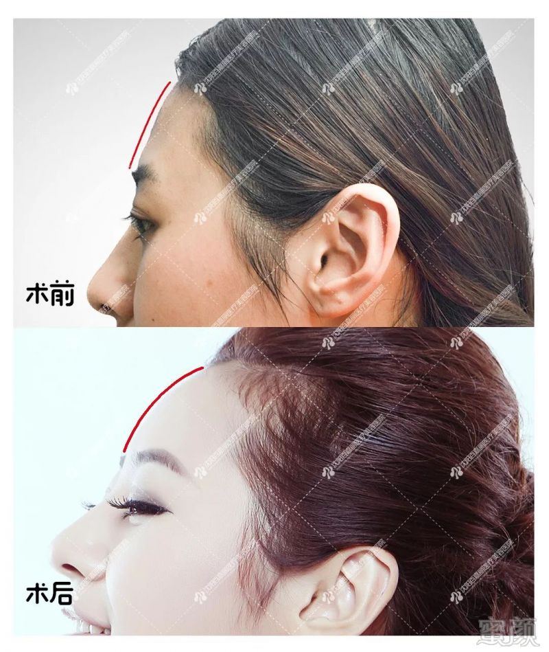 https://img.miyanlife.com/mnt/timg/190830/13052U1N-2.jpg