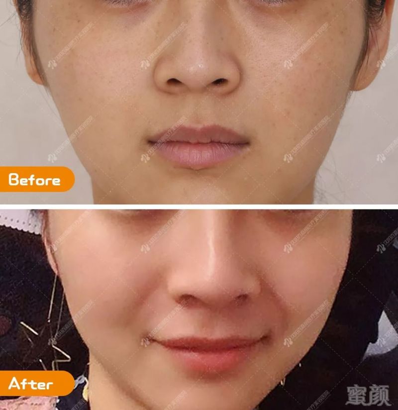 https://img.miyanlife.com/mnt/timg/190830/13053011F-5.jpg
