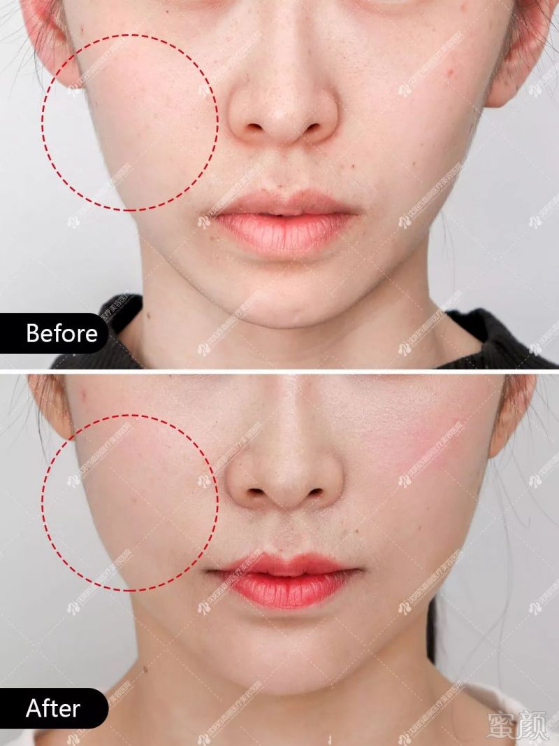 https://img.miyanlife.com/mnt/timg/190830/130531J32-6.jpg