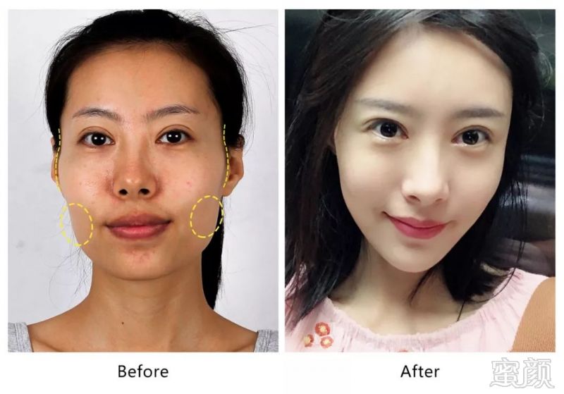 https://img.miyanlife.com/mnt/timg/190830/1305332S2-8.jpg