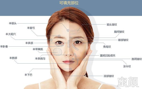 https://img.miyanlife.com/mnt/timg/190830/130Q31446-9.jpg