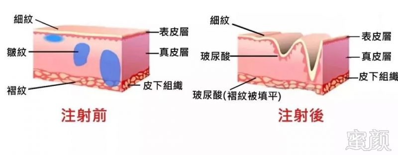 案例图片