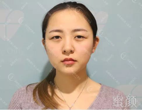 https://img.miyanlife.com/mnt/timg/190831/12341J418-12.jpg