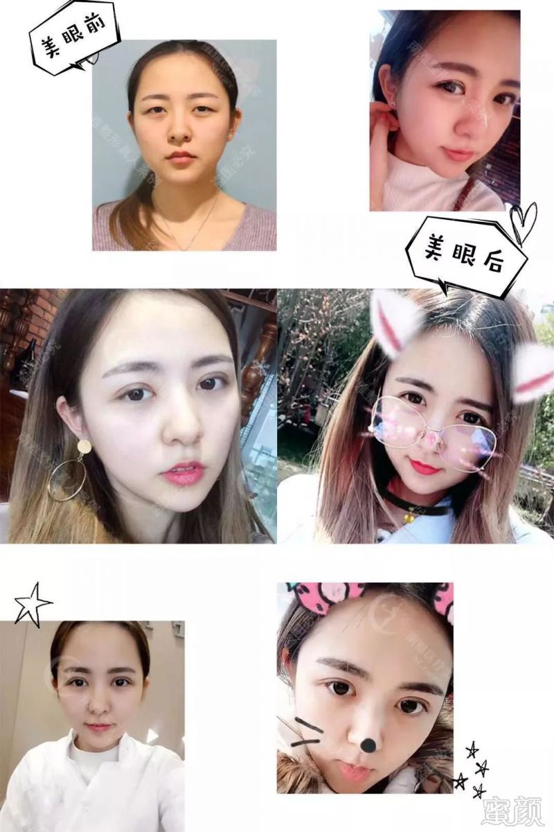 https://img.miyanlife.com/mnt/timg/190831/12341MU7-13.jpg