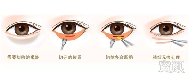 https://img.miyanlife.com/mnt/timg/190831/1243235445-7.jpg