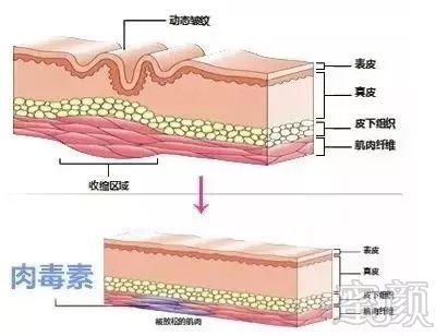 案例图片